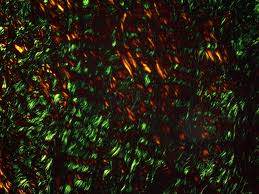 Image result for Polarized Microscopy