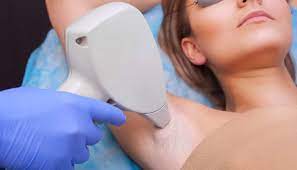 Proper preparation and aftercare can also affect how long the results last. Is Laser Hair Removal Permanent And Is It Safe
