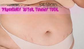 Can you have kids after a tummy tuck? Learn Pregnancy After Tummy Tuck Life Cycle Blog