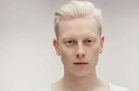 Polycoria: Causes, Symptoms & Treatments