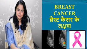 Breast cancer symptoms in hindi, download this wallpaper for free in hd resolution.breast cancer symptoms in hindi was posted in august 24, 2015 at 2:25 am. à¤¸ à¤¤à¤¨ à¤• à¤¸à¤° à¤• à¤²à¤• à¤·à¤£ Breast Cancer Symptoms Hindi Breast Cancer Signs Youtube