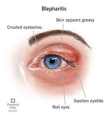 Image result for Blepharis gazensis