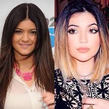 Do you think kylie jenner is more beautiful after the plastic surgery. What Did Kylie Jenner Do To Make Her Eyes Bigger And Eyelids Sultry