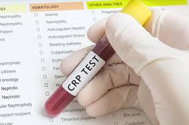 End the cycles if the scene becomes unsafe or you cannot continue performing cpr due to exhaustion. C Reactive Protein Crp Test High Levels Low Levels And Normal Range