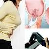 Turun peranakan atau prolaps uteri terjadi ketika posisi rahim turun ke bawah. 1