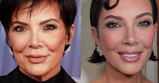 Dr. Thomas Loeb (@dr_thomasloeb) · New York, NY