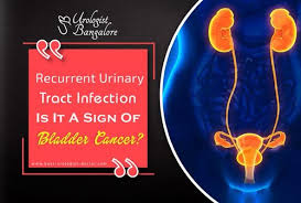 How do doctors tell if i have bladder cancer? Bladder Cancer à¤• à¤¸à¤° à¤Ÿ à¤° à¤Ÿà¤® à¤Ÿ à¤¸à¤° à¤µ à¤¸ à¤• à¤¸à¤° à¤• à¤‰à¤ªà¤š à¤° In Bengaluru Dr Mahendra Jain Id 21012591797