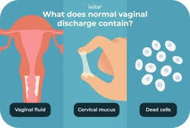 Image result for Vaginal Discharge Testing