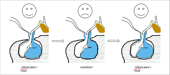 Premenstrual dysphoric disorder, or pmdd, is a severe form of premenstrual syndrome (pms) that may interfere with work, social activities, and relationships. A Proposed Pathophysiological Model For Cyclic Pms Pmdd Symptoms The Download Scientific Diagram