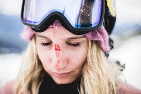 Anna faris net worth and salary: Druhy Zustat Vzhuru Vrazda Anna Gasser Snowboard Richmondfuture Org
