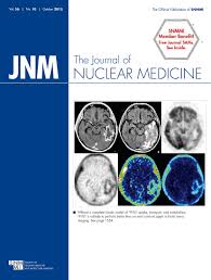 Hvilken informasjon kan pet scanning gi om en svults. 18f Fdg Pet Is An Early Predictor Of Overall Survival In Suspected Atypical Parkinsonism Journal Of Nuclear Medicine