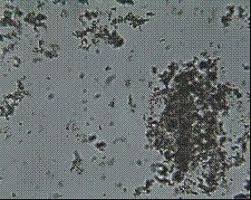 Amorphous Phosphate Crystal How To Dry Basil Herbs Crystals