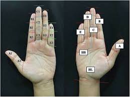Sarawak's population is very diverse, comprising many races and ethnic groups. Estimation Of Stature From Hand And Handprint Measurements In Iban Population In Sarawak Malaysia And Its Applications In Forensic Investigation Sciencedirect