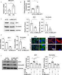 Modelling pollutant generation coefficients in holstein dairy production. Frontiers Laminar Flow Protects Vascular Endothelial Tight Junctions And Barrier Function Via Maintaining The Expression Of Long Non Coding Rna Malat1 Bioengineering And Biotechnology