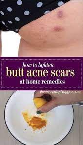 Pin On Skin Care