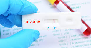 Rapid Covid 19 Test Available All Locations Mydoc Urgent Care