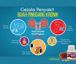 Istilah buah pinggang apa artinya? Sihat Badan 2 0 Gejala Penyakit Buah Pinggang Kronik Facebook
