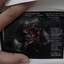 We did not find results for: Beazara Scan Baby Boy Ke Baby Girl