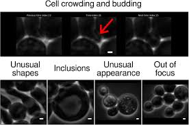 Maybe you would like to learn more about one of these? Yeaz A Convolutional Neural Network For Highly Accurate Label Free Segmentation Of Yeast Microscopy Images Biorxiv