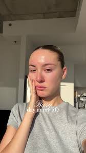 day in my life ❣️ pour les soins, skincare, consultation c’est à la  clinique @@dermarea @KB PURE