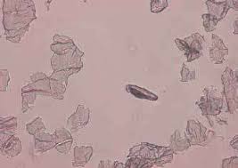 Image result for Demodex brevis