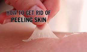9 Tips On How To Get Rid Of Peeling Skin On Face Hands Feet Peeling Skin Dry Skin On Face Dry Peeling Skin
