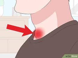 If you have thyroid cancer, you probably have this type. How To Diagnose Thyroid Cancer With Pictures Wikihow