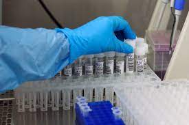 Confirman caso de fiebre hemorrágica de marburgo en guinea. Reportan Primer Caso De Virus Marburgo En Africa Provoca Fiebre Hemorragica Internacional Biobiochile