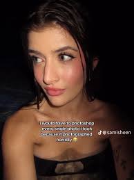 Sami Sheen Richards Nose