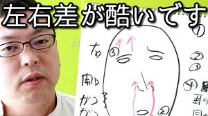 左右差が酷いです 左眉 左目が上がり鼻は左に曲がって輪郭も左の方が大きい 酷い 左目 眉