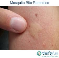 Pin On Pests