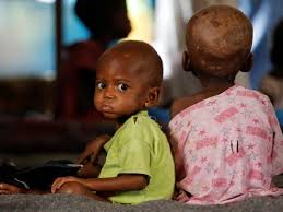 Drought, poverty and conflict have impacted every aspect of their lives. Hunger Causes Almost Half Of All Child Deaths In Africa Report Says The Independent The Independent