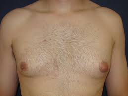 A potion to cure feminization [mtf/tgtf; Male Breast Feminization Xxgasm