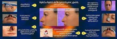 تجميل الانف تكلفة و أسعار عمليات التجميل للأنف أفارا