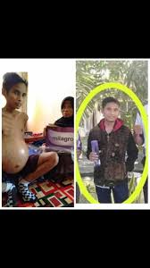 Penyakit liver penyakit hati adalah suatu kondisi penyakit yang disebabkan oleh berbagai faktor warna feses pucat, atau berdarah. Elni Ny Prabowo Milagros Vs Hepatitis Sakit Kuning Facebook