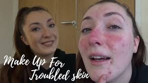 EVERYDAY MAKE UP FOR TROUBLED SKIN/ROSACEA//LAURENMEE