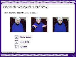 It tests three signs for abnormal findings which may indicate that the patient is having a stroke. Ems Assessment And Care For Cva Ppt Download