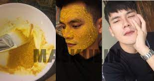 Serum penting utk merawat kulit kita yg semakin kurang. Guna Kunyit Je Cara Lelaki Ni Hilangkan Jerawat Parut Cerahkan Kulit Maskulin
