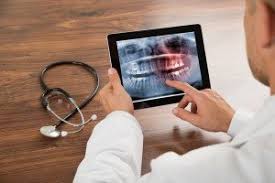 Das ist oft gar nicht so einfach. Wurzelbehandlung Ohne Schmerzen Sensitive Dentists