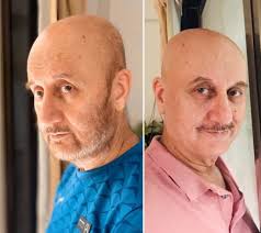 Anupam kher is a famous indian film actor. Anupam Kher Grows A Beard After 37 Years Internet Loves His New Look