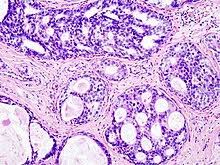 If he is using these terms with you, he's interested. Breast Cancer Wikidata