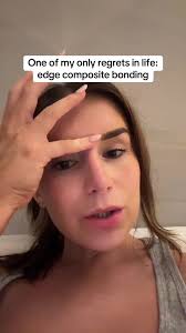 Dentists have played a blinder with this ill give it to them😭 biggest  waste of money ever for me i want it off my teeth so bad🥲 #teeth  #composite #compositebonding