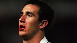 The bloody moment that still haunts Joey Johns