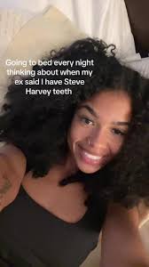 Are Steve Harvey Teeth Real