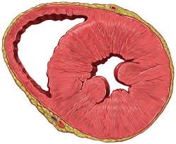 Additional criteria should be used. Sokolow Lyon Electrocardiographic Criteria Medicine Mcq