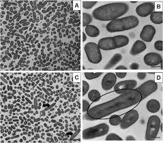 Listeria bacteria under microscope under an oil lens. Frontiers Listeria Monocytogenes Response To Sublethal Chlorine Induced Oxidative Stress On Homologous And Heterologous Stress Adaptation Microbiology