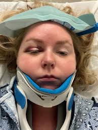 Two friends land in hospital after bike accident, family raises funds to  help