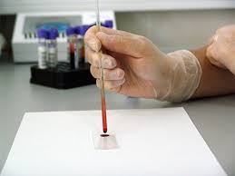 We did not find results for: Taking A Blood Pregnancy Test