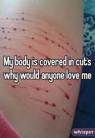 My Body Is Covered In Cuts Why Would Anyone Love Me