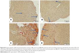 Arthur cabral — sexta feira 04:18. Simvastatin Prevents Isoproterenol Induced Cardiac Hypertrophy Through Dddt
